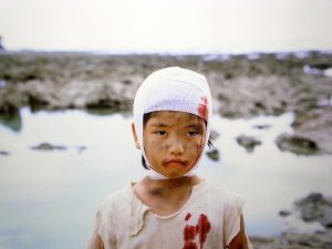 沖縄戦で負傷した子供