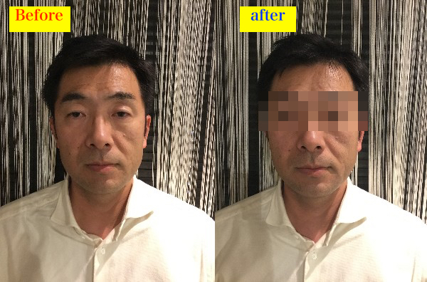 男の眉毛 アラフィフでも有効 疲れ切ったオジサン顔 が5歳若返る眉毛スタイリング ハーバー ビジネス オンライン