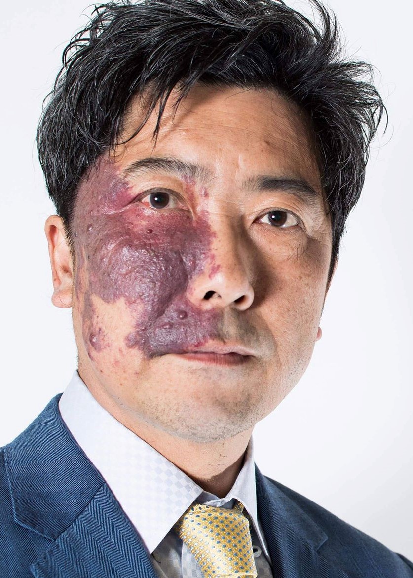 ユニークフェイス問題のパイオニアが語る 今日まで そして明日から ハーバー ビジネス オンライン