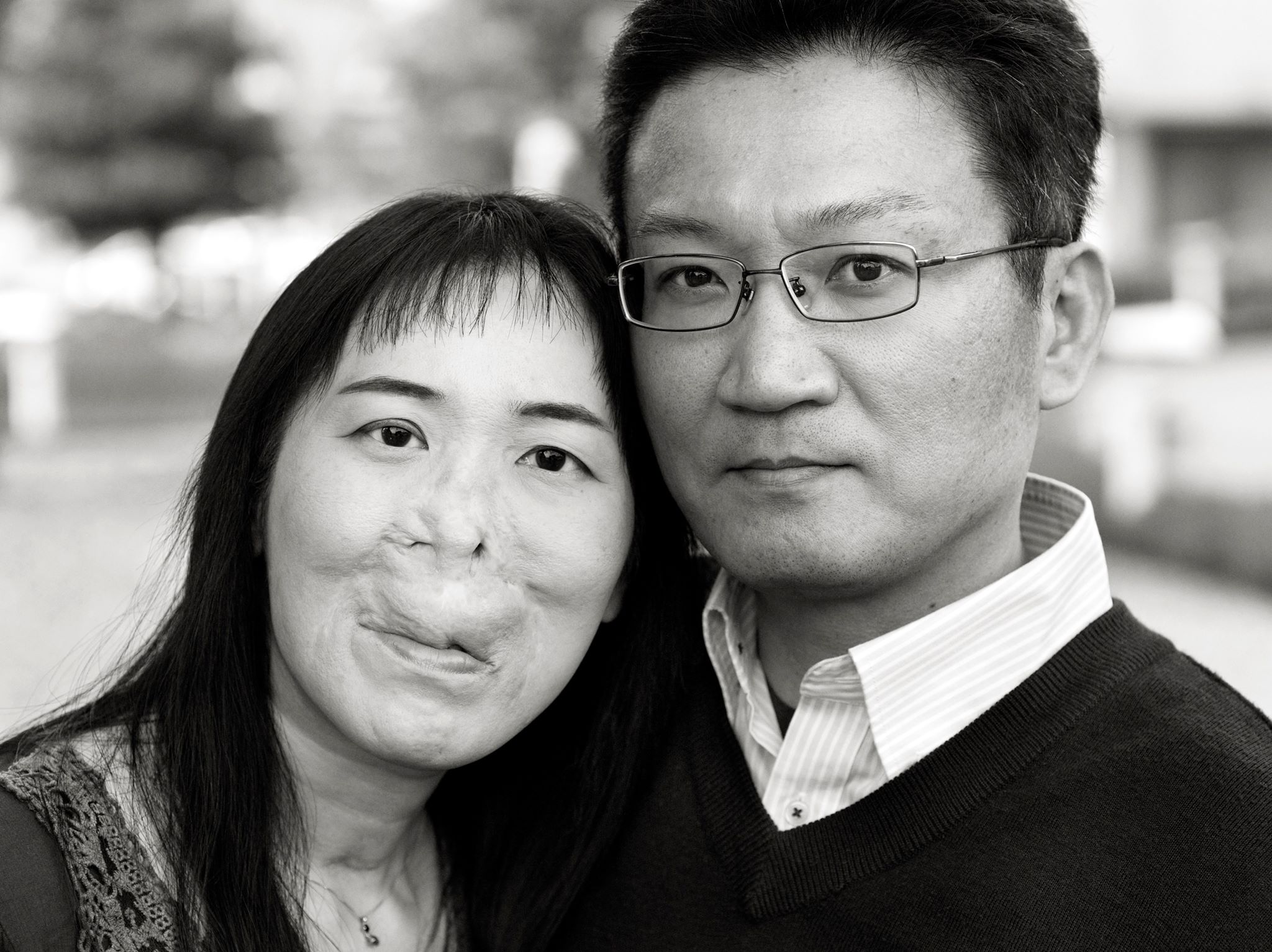 写真を通じて問いかけられる「恋愛、容姿、差別とは」……ユニークフェイス夫婦写真展、表参道駅で24日まで ハーバー